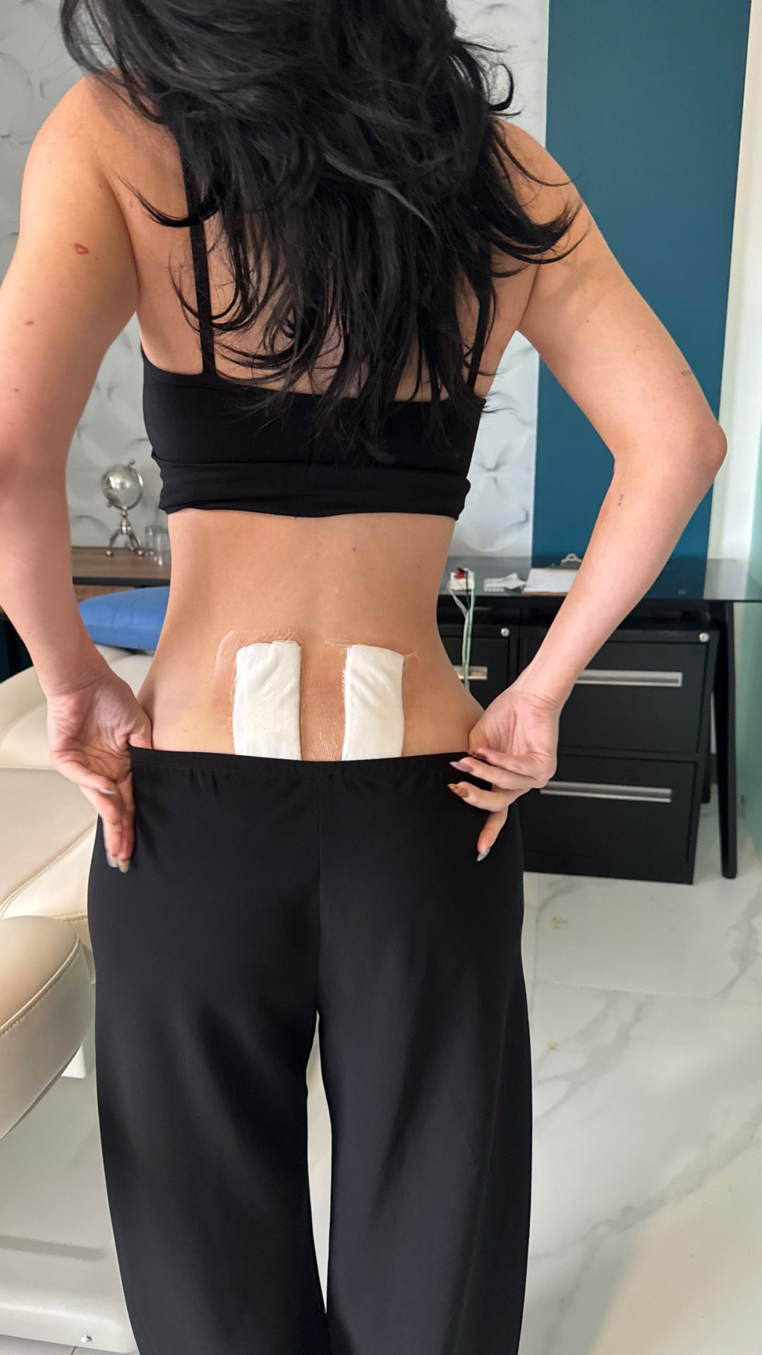 Кайли Дженнер откровенно рассказала о своем лечении хронической боли в спине