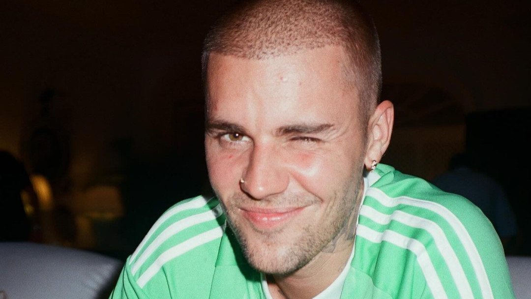 Джастин Бибер получил серьезную травму