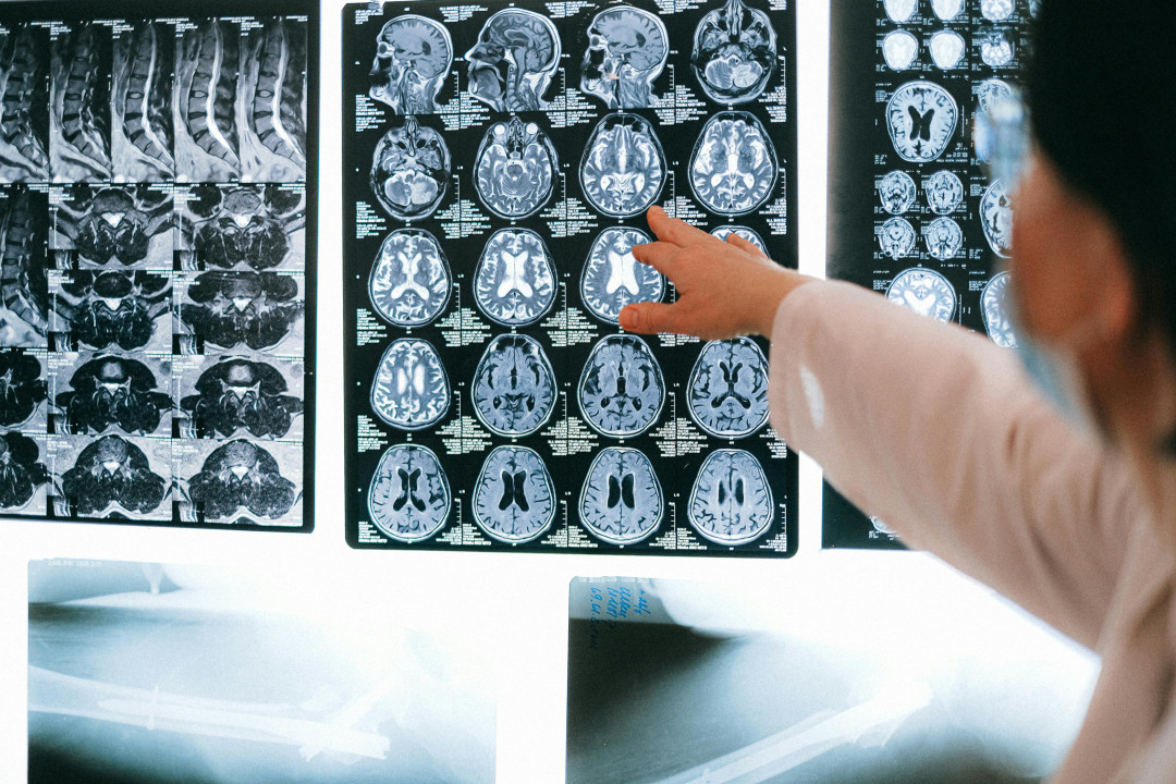 doctor-examining-mri-brain-scans-image