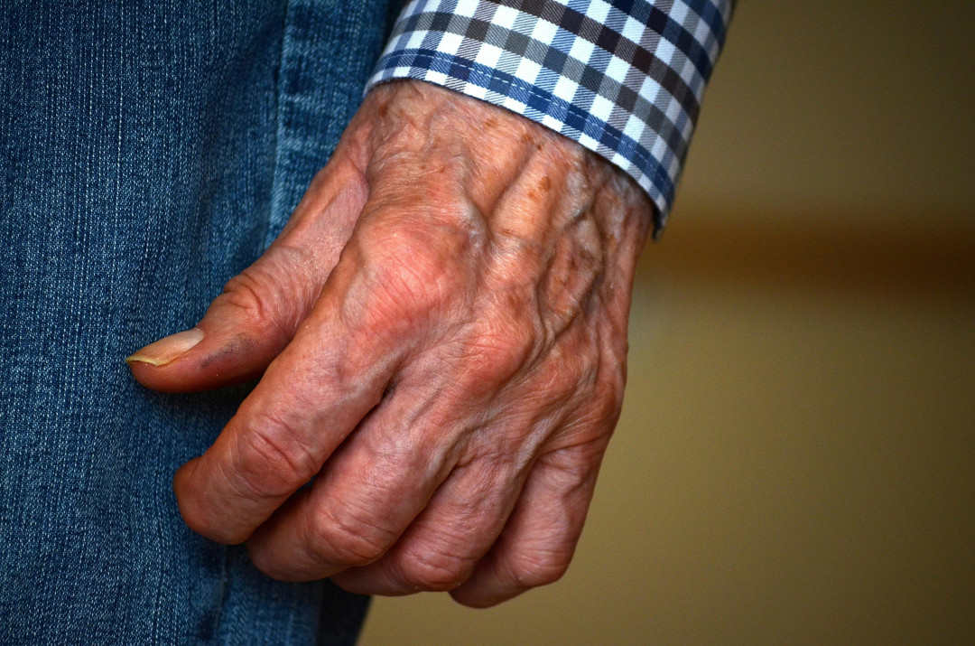 elderly-mans-hands-showing-aging-skin-texture-portrait-hands-image