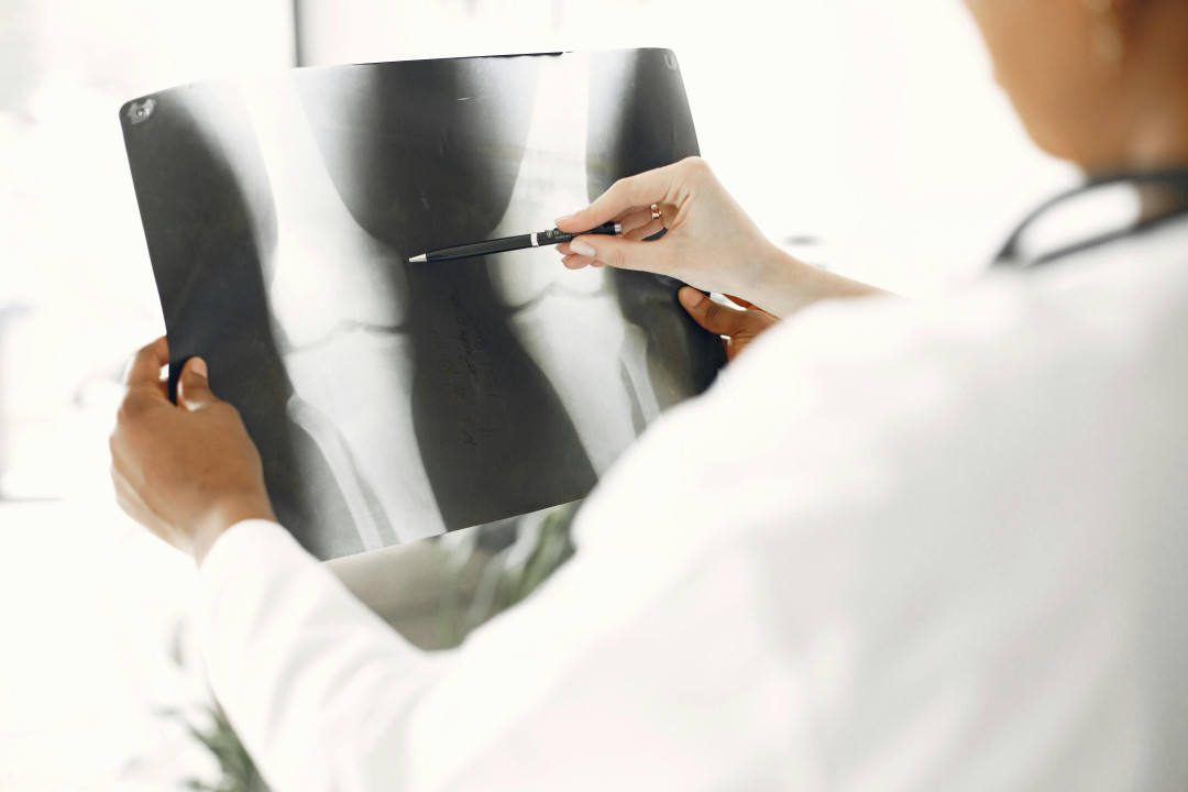 doctor-examining-hip-xray-with-pen-in-clinic-image