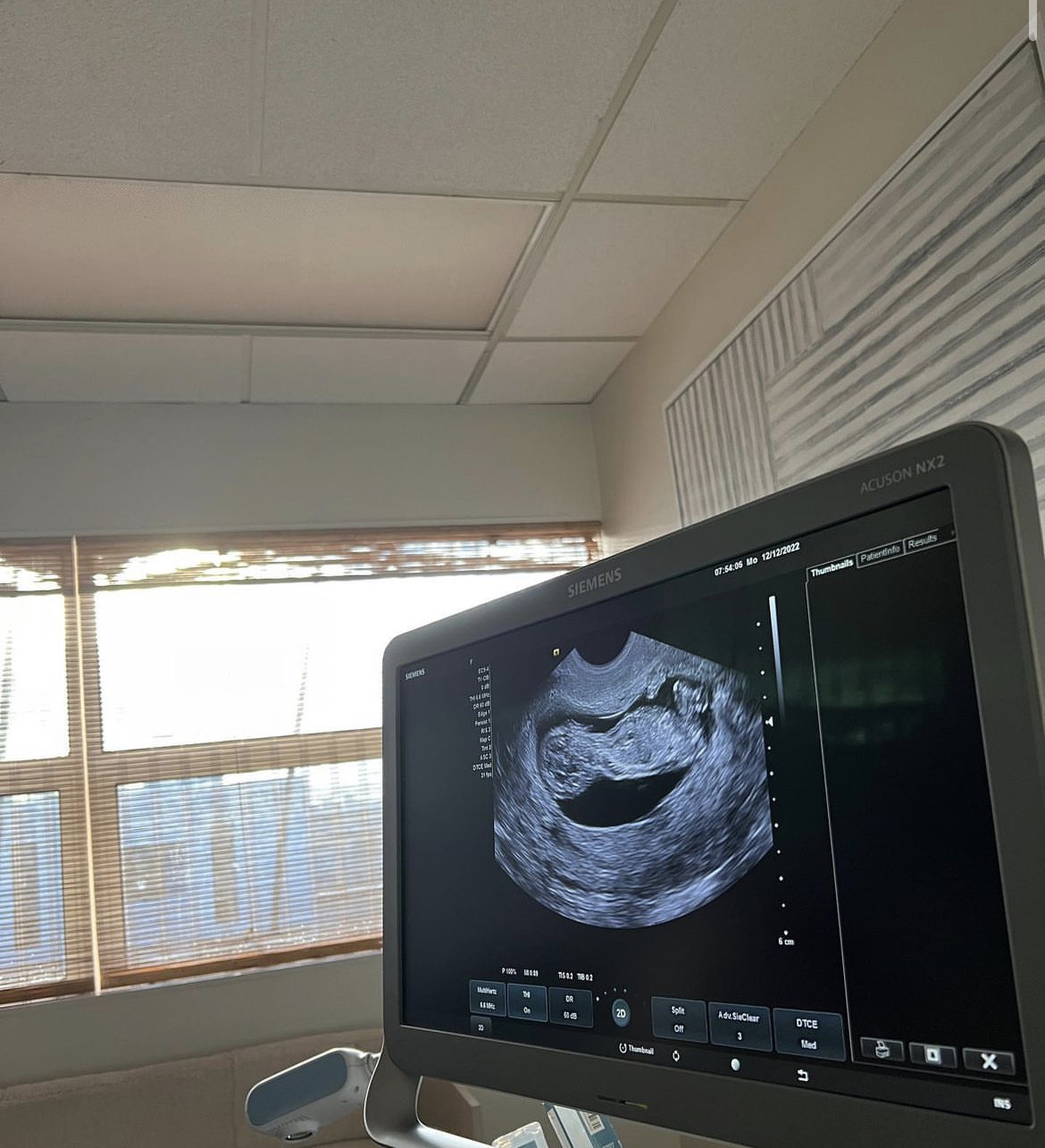 Наоми Осака о беременности