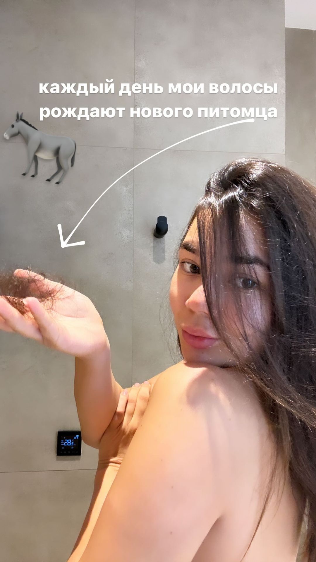 Карина Оксукпаева алопеция