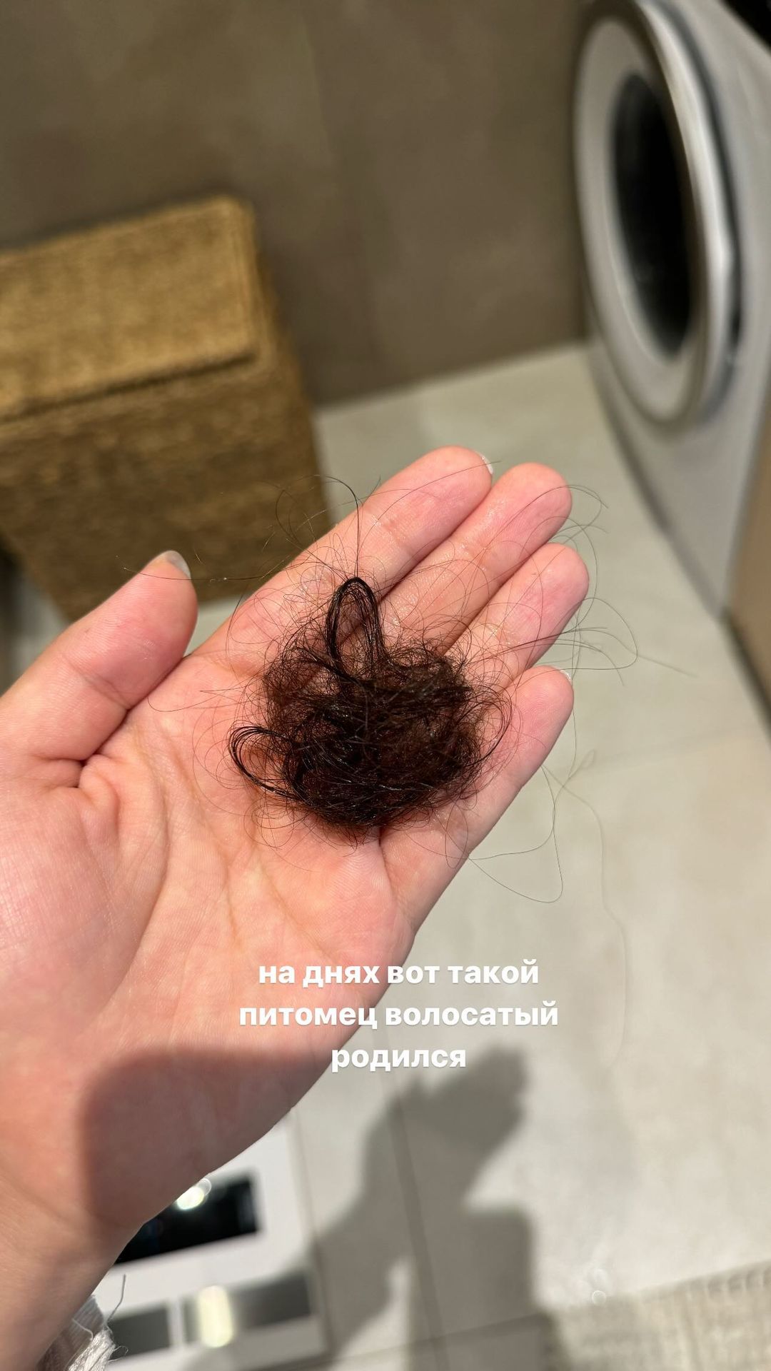 Карина Оксукпаева алопеция