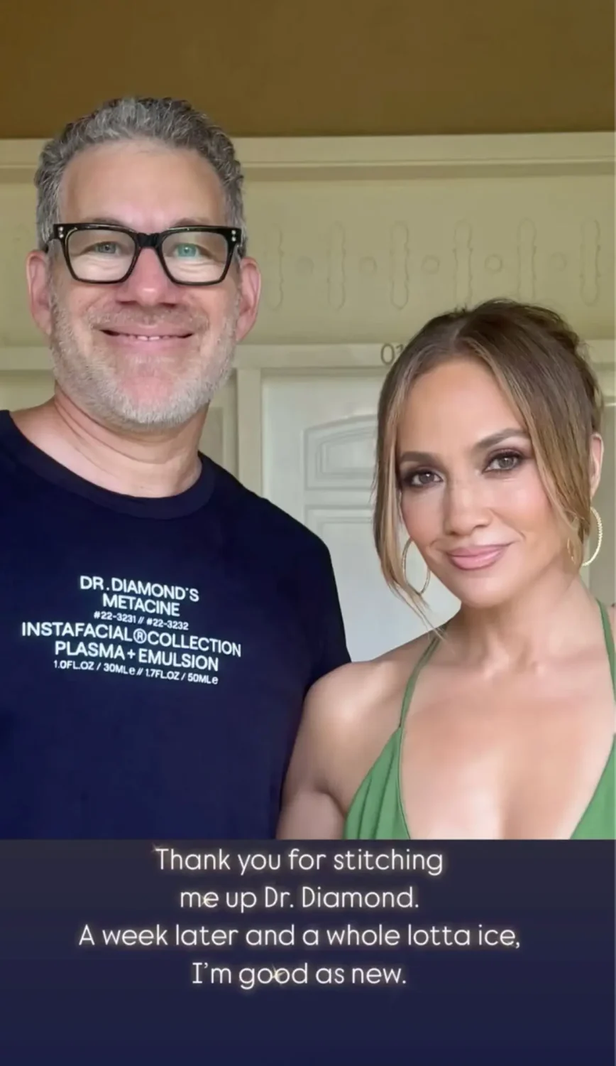 «Итак, это случилось…»: Дженнифер Лопес получила травму во время репетиции шоу, где она выступит ведущей