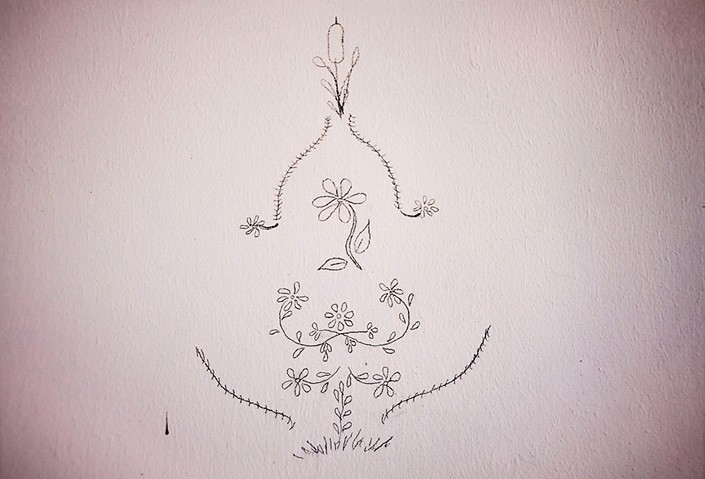 КЛИНИЧЕСКИЙ СЛУЧАЙ 15 Февраля 2017 0:00