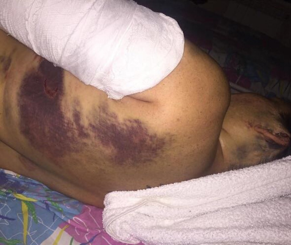 Каково это – перехитрить троих убийц и остаться в живых