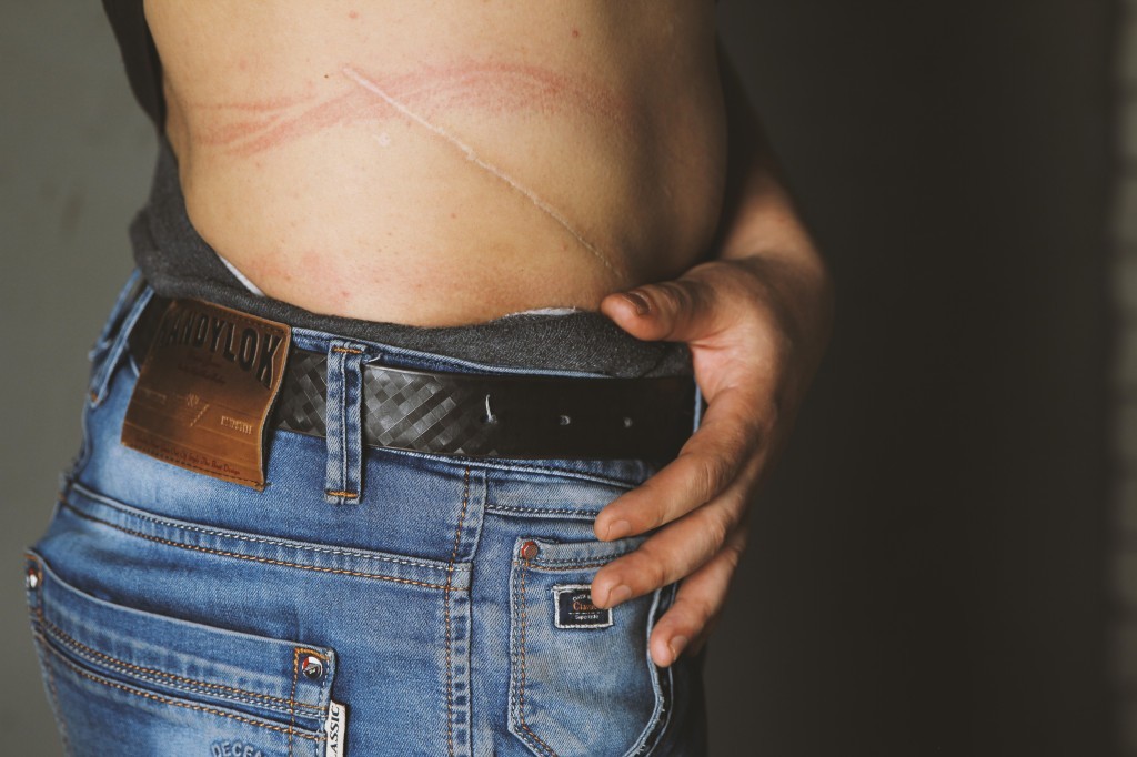 Каково это – продать свою почку